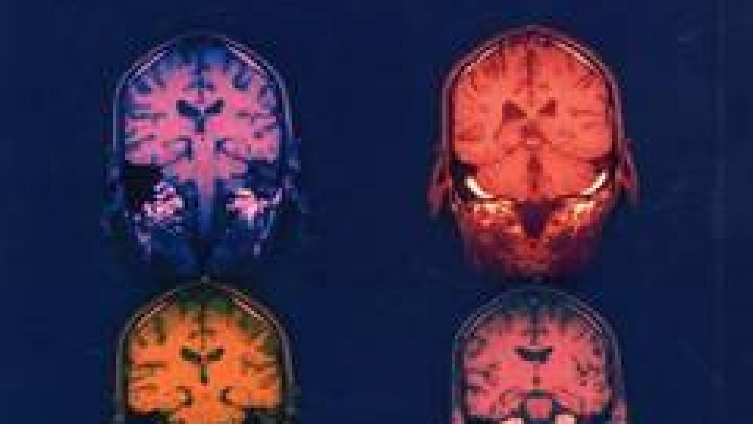 התשתית המסתורית של חיי הרגש.

מה קורה במוח כשאנו מרגישים פחד, אהבה, שנאה, כעס, אושר? האם אנו שולטים ברגשותינו או שהם שולטים בנו? האם לבעלי חיים יש רגשות? איך יכולות חוויות טראומטיות בשחר הילדות להשפיע על התנהגותו של המבוגר אף שאין הוא זוכר אותם כלל במודע?

תחום הרגשות הוא תחום בעייתי למדע. מאחר שהרגשות הם סובייקטיביים ולא-רציונליים, קשה לחקור אותם באופן אובייקטיבי, ועל כן שנים רבות נמנעו מדע המוח והמדע הקוגניטיבי מלעסוק בהם.